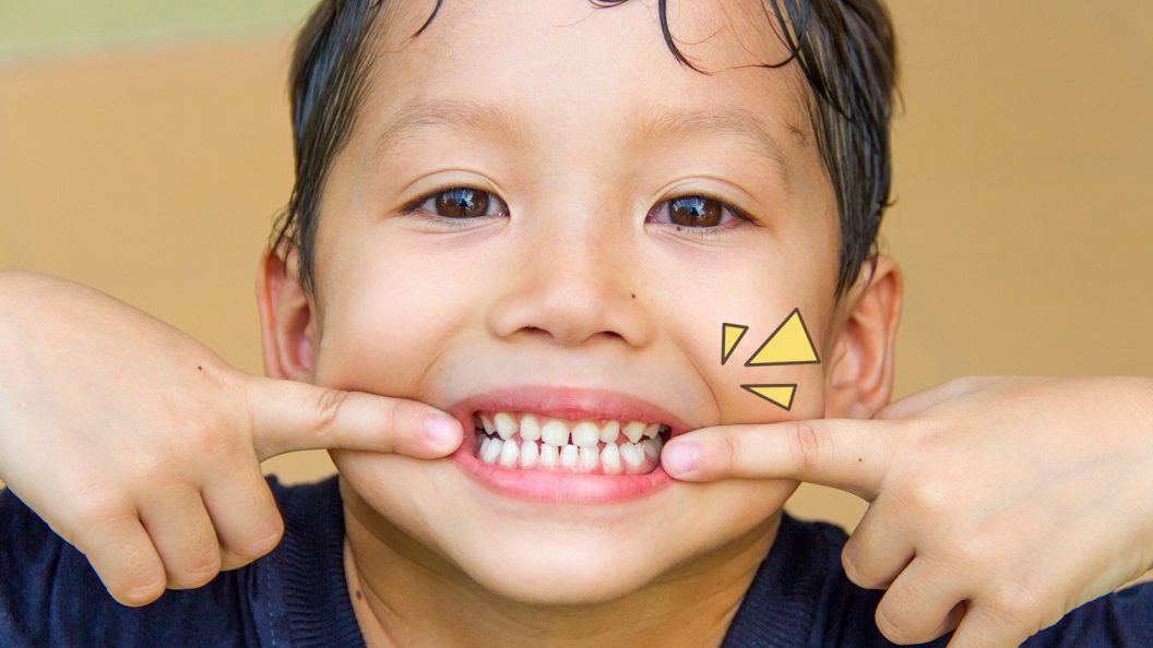 Cara Menjaga Kebersihan Gigi Anak